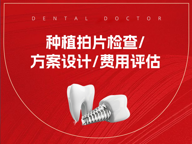 种植拍片检查/方案 设计/费用评估